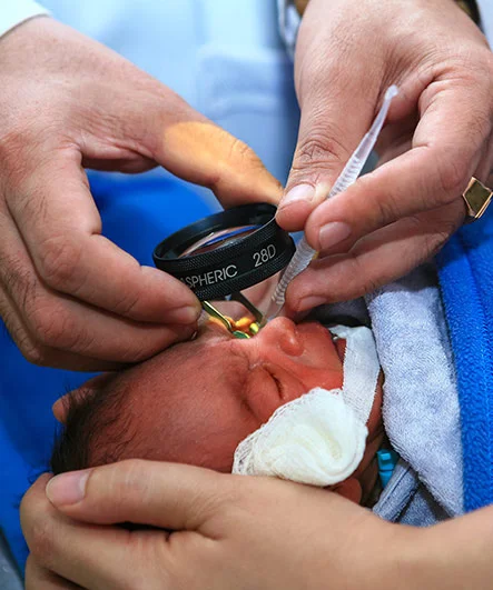 ROP Screening for Premature Infants at Retinova Eye Care Hyderabad